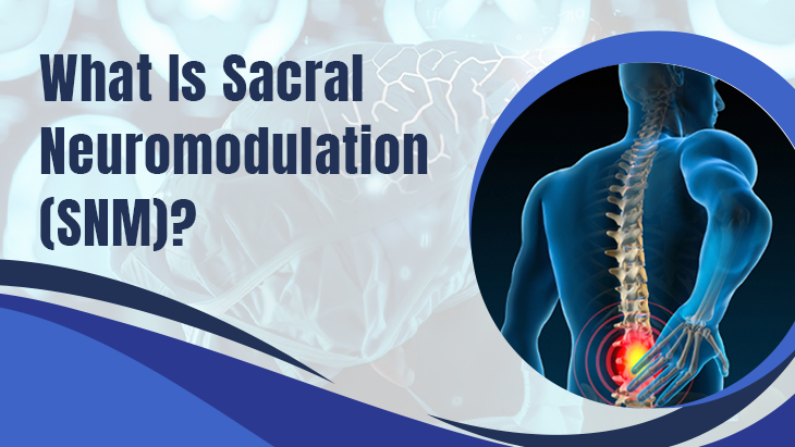 What is Sacral Neuromodulation (SNM)?