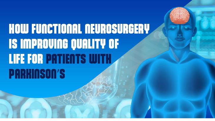 How Functional Neurosurgery is Improving Quality of Life for Patients with Parkinson’s