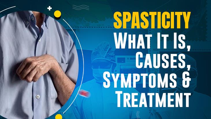 Spasticity What It Is, Causes, Symptoms & Treatment