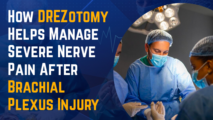 How DREZotomy Helps Manage Severe Nerve Pain After Brachial Plexus Injury