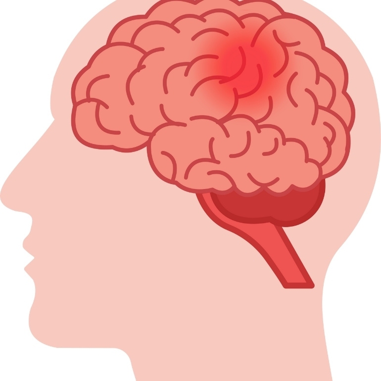Neurological conditions